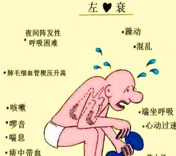 慈林科普心力衰竭有哪些表现